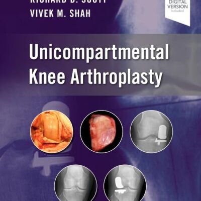 UNICOMPARTMENTAL KNEE ARTHROPLASTY, 1ST EDITION