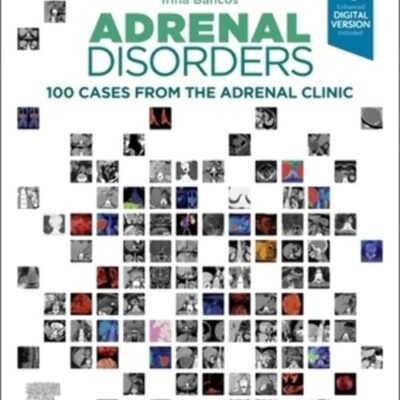 Adrenal Disorders: 100 Cases from the Adrenal Clinic - 1E