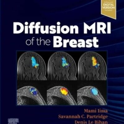 Diffusion MRI of the Breast - 1E