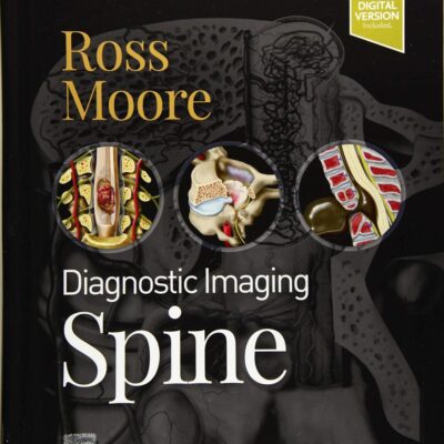 DIAGNOSTIC IMAGING: SPINE: 4TH EDITION