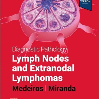 Diagnostic Pathology: Lymph Nodes and Extranodal Lymphomas