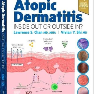 Atopic Dermatitis: Inside Out or Outside In - 1E