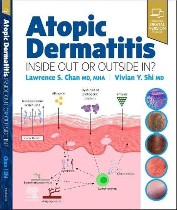 Atopic Dermatitis Inside Out or Outside In 1st Edition Elsevier medical textbook cover