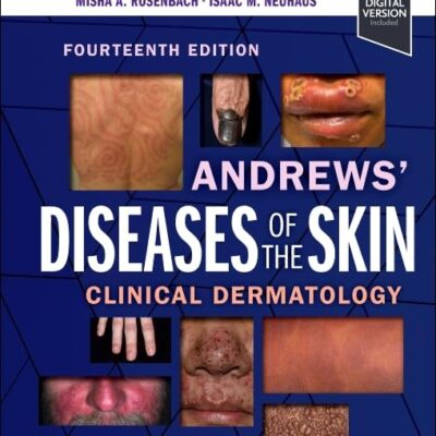 Andrews' Diseases of the Skin: Clinical Dermatology