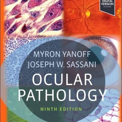 Ocular Pathology