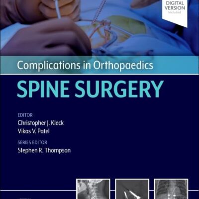 Complications in Orthopaedics: Spine Surgery
