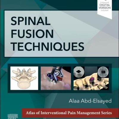 Spinal Fusion Techniques (The Atlas of Interventional Pain Management)