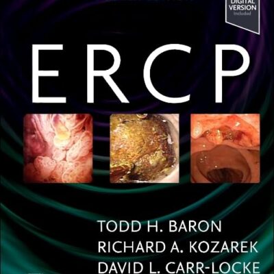 ERCP