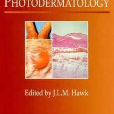 Photodermatology