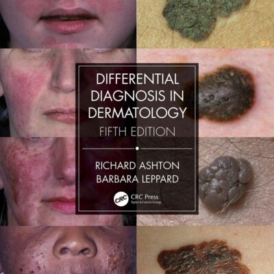 Differential Diagnosis In Dermatology 5Ed (Pb 2021)