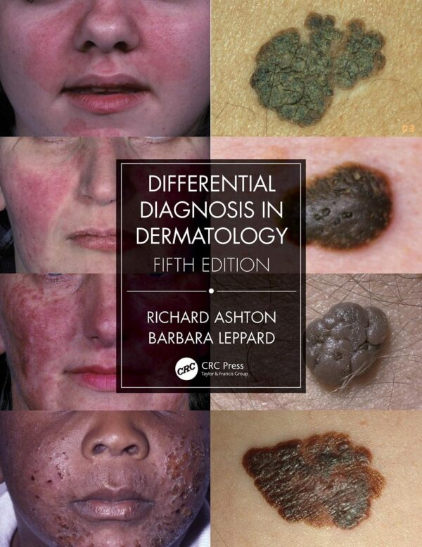 Differential Diagnosis In Dermatology 5Ed (Pb 2021)