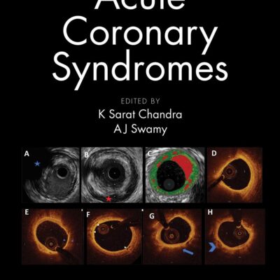 Acute Coronary Syndromes (Pb 2020)