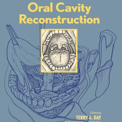 Oral Cavity Reconstruction