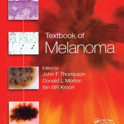 Textbook Of Melanoma (Pb 2020)