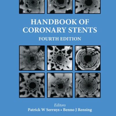 Handbook of Coronary Stents