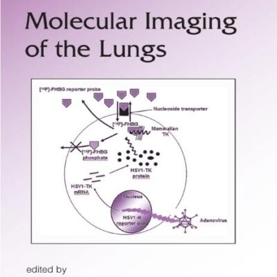Molecular Imaging of the Lungs: 203 (Lung Biology in Health and Disease)
