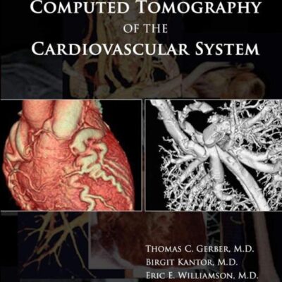 Computed Tomography of the Cardiovascular System