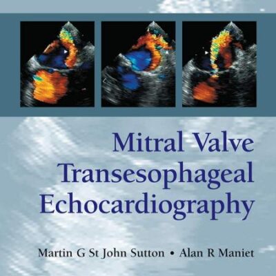 Mitral Valve Transesophageal Echocardiography (Pb 2019)