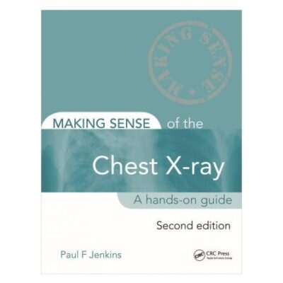 MAKING SENSE OF THE CHEST X-RAY A HANDS ON GUIDE 2ED (PB 2020)