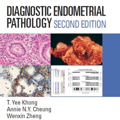 Diagnostic Endometrial Pathology 2E