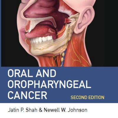 Oral and Oropharyngeal Cancer