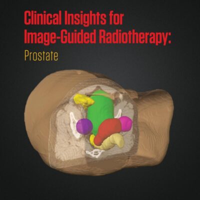 Clinical Insights for Image-guided Radiotherapy: Prostate (Series in Medical Physics and Biomedical Engineering)