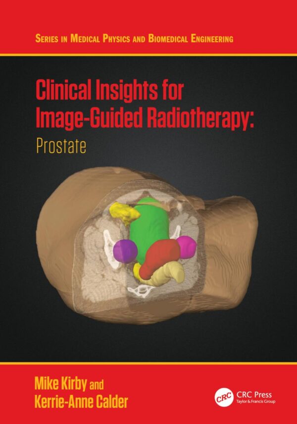 Clinical Insights for Image-guided Radiotherapy: Prostate (Series in Medical Physics and Biomedical Engineering)