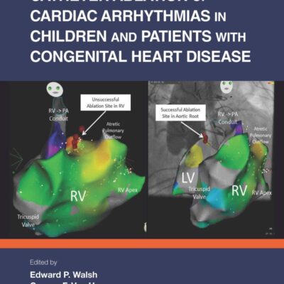 Catheter Ablation of Cardiac Arrhythmias in Children and Patients with Congenital Heart Disease
