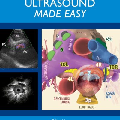 Endobronchial Ultrasound Made Easy: Made Easy