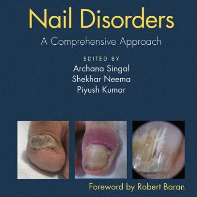 Nail Disorders A Comprehensive Approach (Pb 2020)