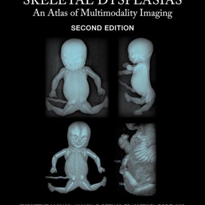 Fetal and Perinatal Skeletal Dysplasias: An Atlas of Multimodality Imaging