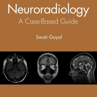 Neuroradiology A Case Based Guide (Pb 2021)