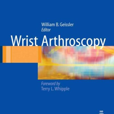 WRIST ARTHROSCOPY