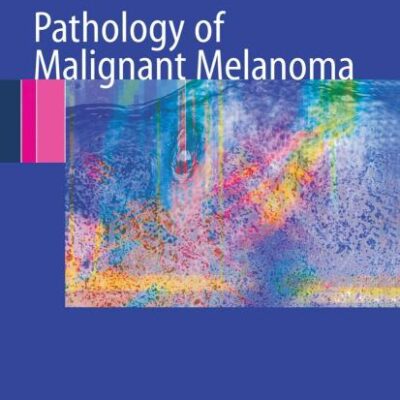 PATHOLOGY OF MALIGNANT MELANOMA