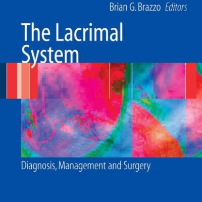 The Lacrimal System:Diagnosis Managment And Surgery