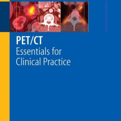 PET/CT
