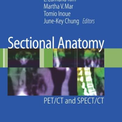 SECTIONAL ANATOMY: PET/CT AND SPECT/CT