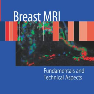 BREAST MRI: FUNDAMENTALS AND TECHNICAL ASPECTS