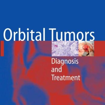 ORBITAL TUMORS: DIAGNOSIS AND TREATMENT