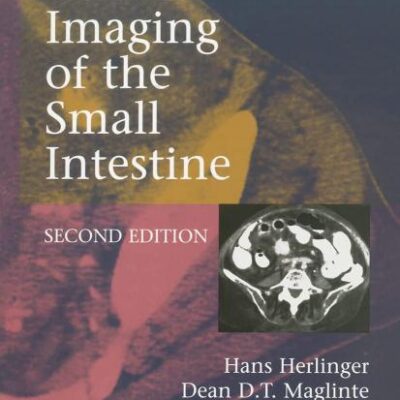 CLINICAL IMAGING OF THE SMALL INTESTINE 2ED (PB)
