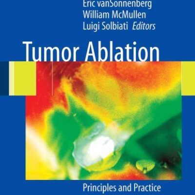 Tumor Ablation (Hb)