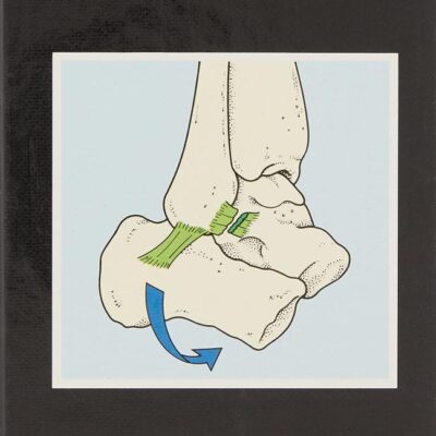 Limb Injuries (Pocket Picture Guides)