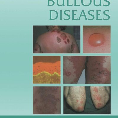 Atlas of Bullous Diseases