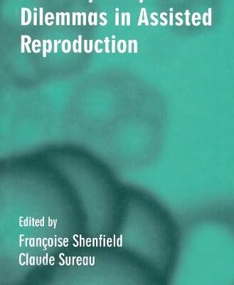 EXERCISE INDUCED ASTHMA, VOL. 130