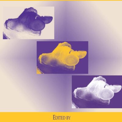 Toxicology of 1 - 3-Beta-Glucans: Glucans as a Marker for Fungal Exposure