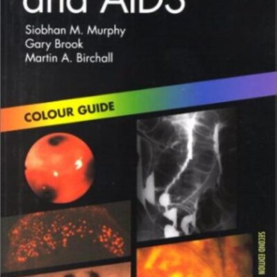 HIV Infection and AIDS (Colour Guides)