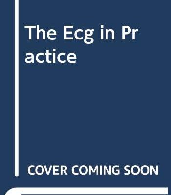 The Ecg in Practice