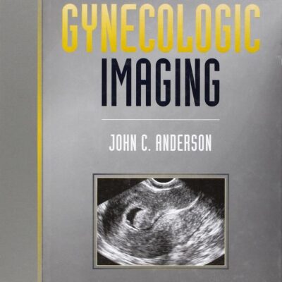 Gynaecologic Imaging, 1e