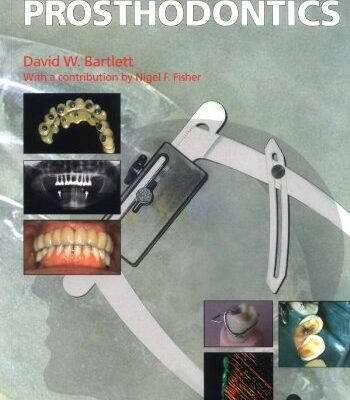 Clinical Problem Solving in Prosthodontics