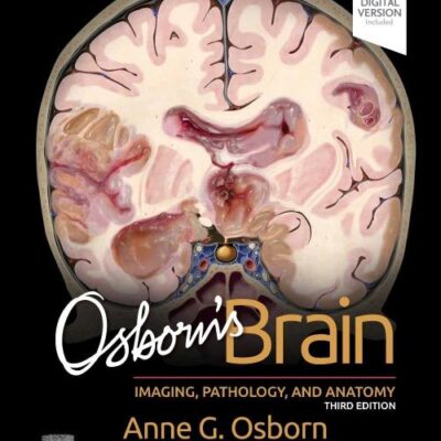 OSBORNS BRAIN IMAGING PATHOLOGY AND ANATOMY WITH ACCESS CODE 3ED (HB 2024)